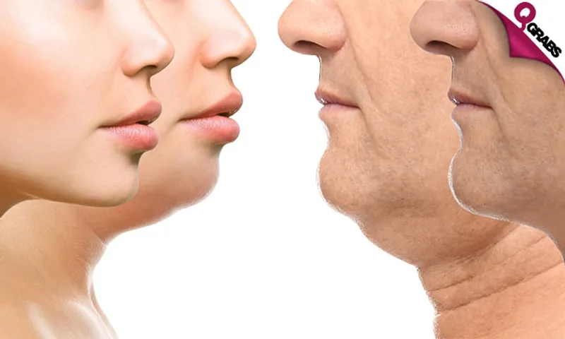 Rejuvenating HIFU Treatment!